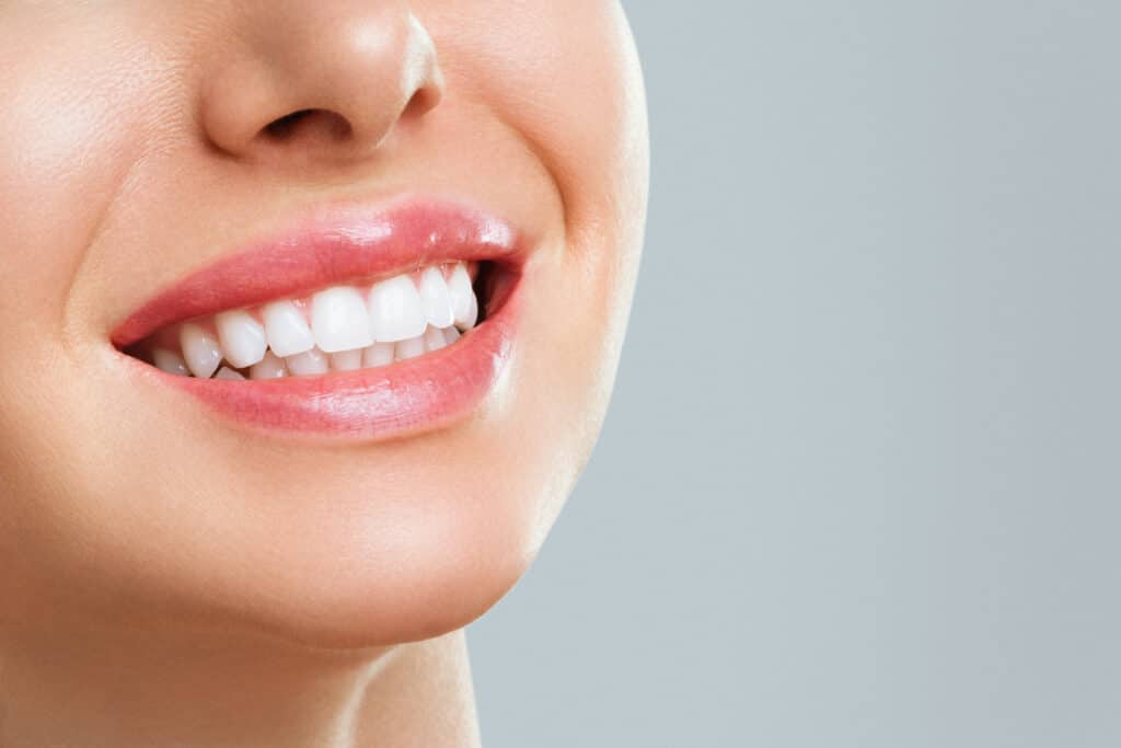 How to Maintain a Bright Smile After Teeth Whitening in Cincinnati