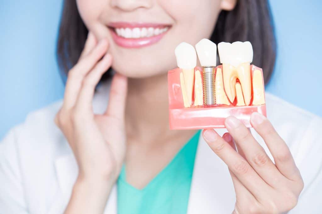 How Dental Implants Can Restore Your Confidence and Transform Your Smile