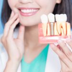 How Dental Implants Can Restore Your Confidence and Transform Your Smile